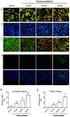 Investigation of Apoptosis Induction in Differentiated PC-12 Cells after Exposure to Hydrostatic Pressure