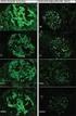 Immunofluorescence. UV microscope. fixed or frozen tissue. add primary antibody. add FITC-conjugated antibody