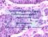 Νευροενδοκρινείς όγκοι Παθολογοανατομική προσέγγιση. Χριςτίνα Ηουμποφλη Επιμ. Α Πακολογοανατομικό Εργαςτιριο Γ.Ν. «Ιπποκράτειο» Ακθνϊν