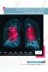 17Νοεμβρίου2018. Αντιμετώπιση Καρκίνου του Πνεύμονα με επέκταση στο Θωρακικό Τοίχωμα και άλλων Όγκων Θωρακικού Τοιχώματος